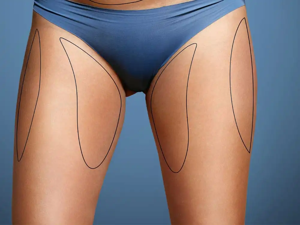 découvrez des conseils efficaces et des exercices ciblés pour réduire la culotte de cheval et affiner votre silhouette facilement.